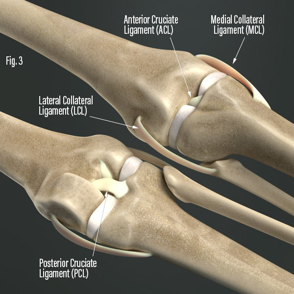 Knee Decompression Ligaments Treated